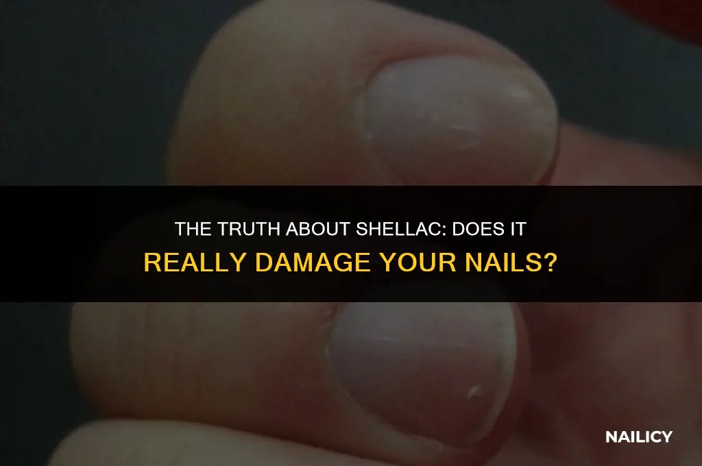 does using shellac damage your nails