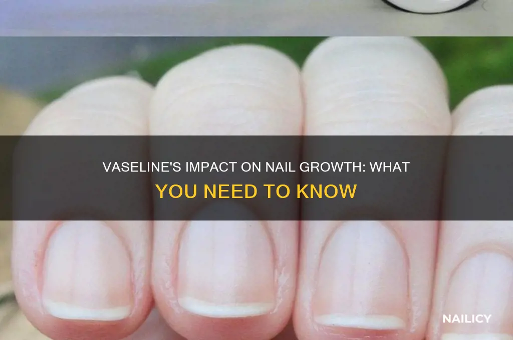 does vaseline make your nails grow