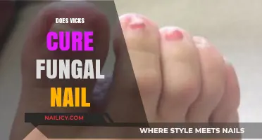 Can Vicks Vaporub Effectively Treat Fungal Nail Infections? Find Out