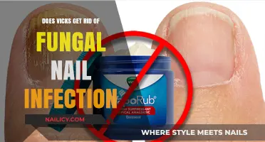 Combatting Fungal Nail Infections: The Surprising Role of Vicks Vaporub