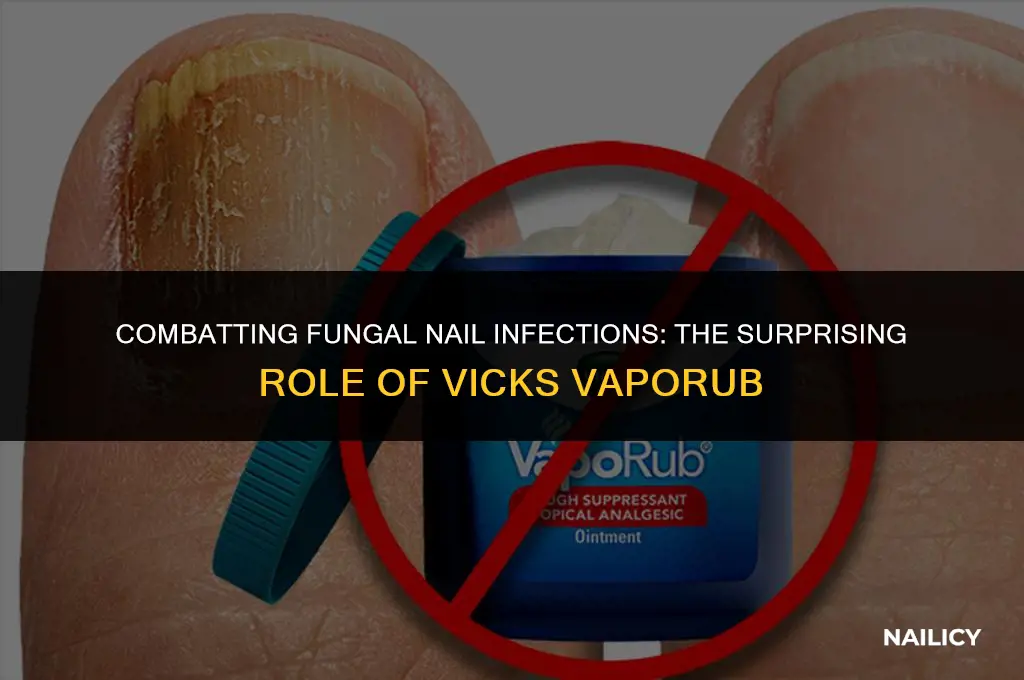 does vicks get rid of fungal nail infection