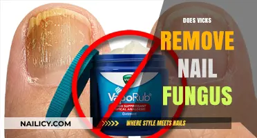 Vicks VapoRub: Effective Nail Fungus Treatment?