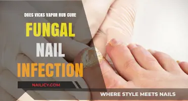 Can Vicks Vapor Rub Treat Fungal Nail Infections? Facts Revealed