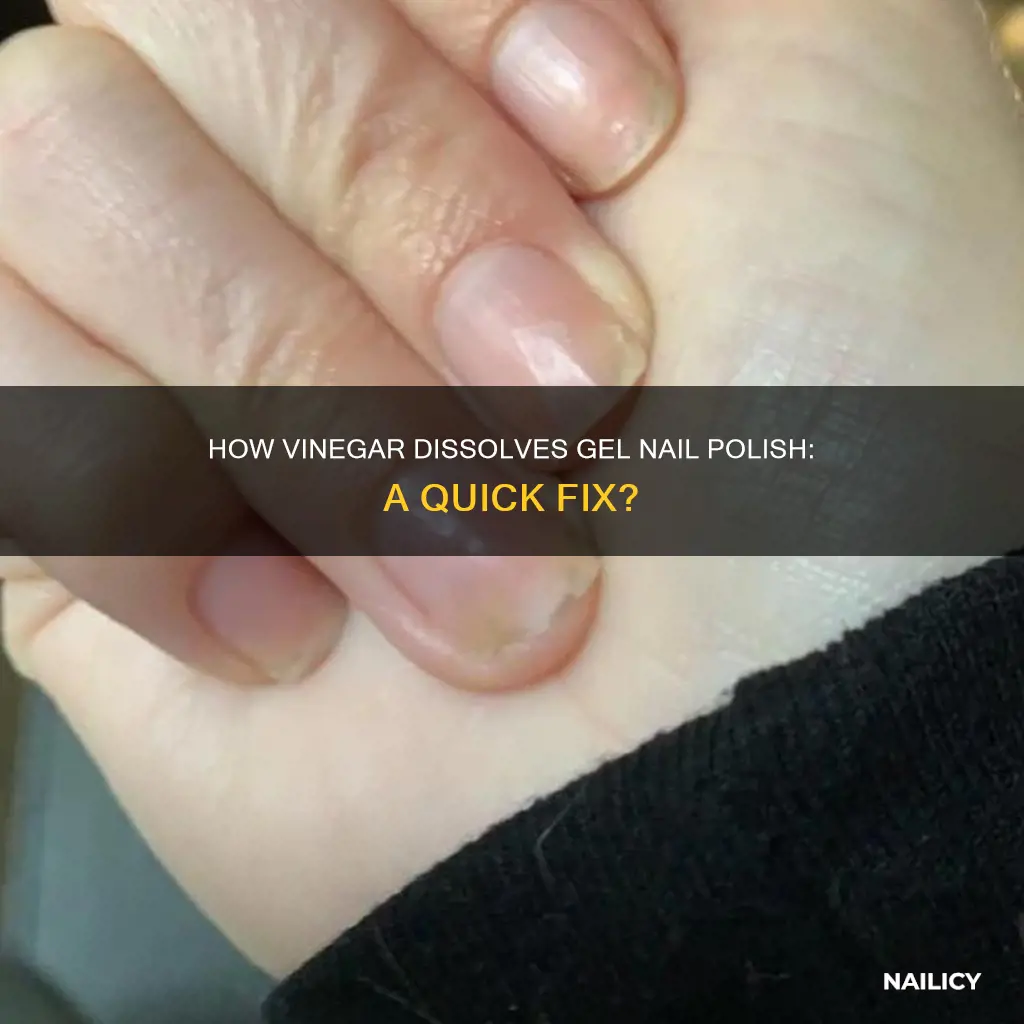 does vinegar break down gel nail polish