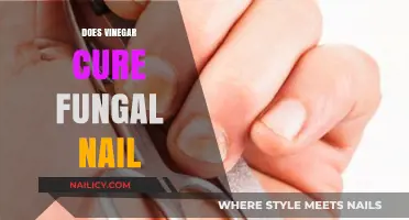 Can Vinegar Effectively Treat Fungal Nail Infections? Facts and Myths