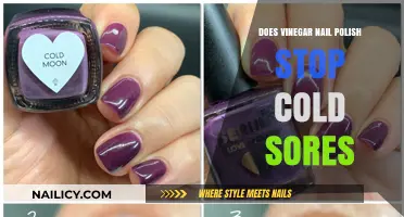 Can Vinegar Nail Polish Really Prevent Cold Sores? The Truth Revealed