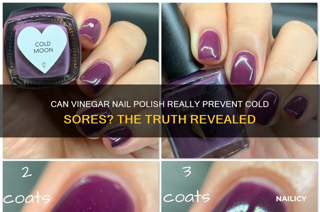 does vinegar nail polish stop cold sores