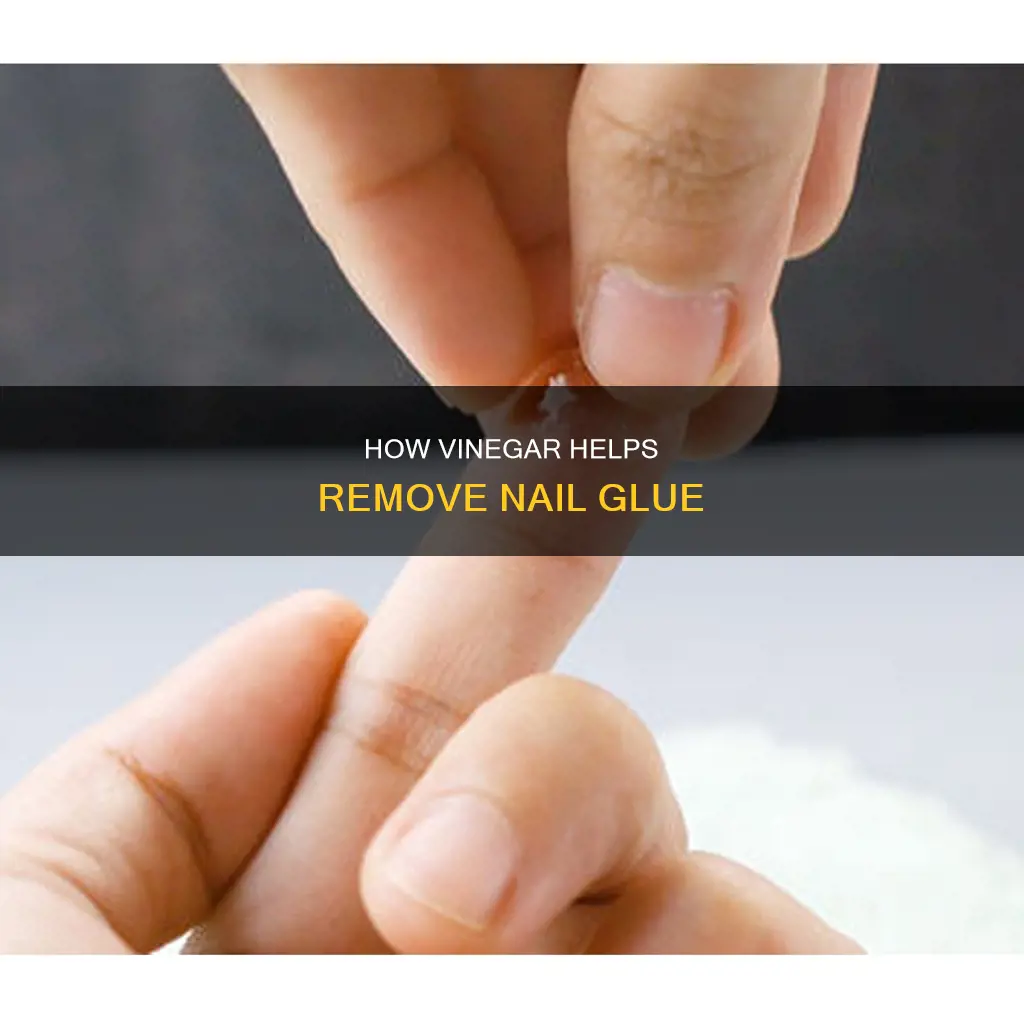 does vinegar remove nail glue