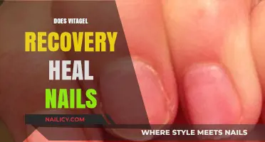 Vitagel Recovery for Nail Healing: Does It Really Work?
