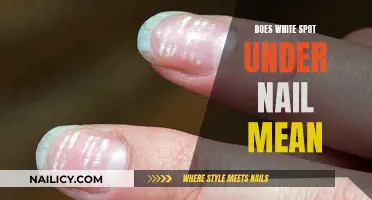 White Spot Under Nail: What It Could Mean