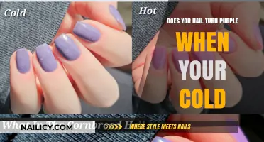 Why Nails Turn Purple in Cold Weather: Causes and Concerns
