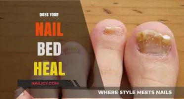 Nail Bed Healing: Understanding Recovery, Repair, and Regeneration Process
