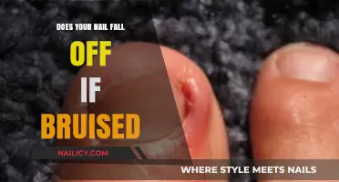 Nail Bruises: Will Your Nail Fall Off After an Injury?