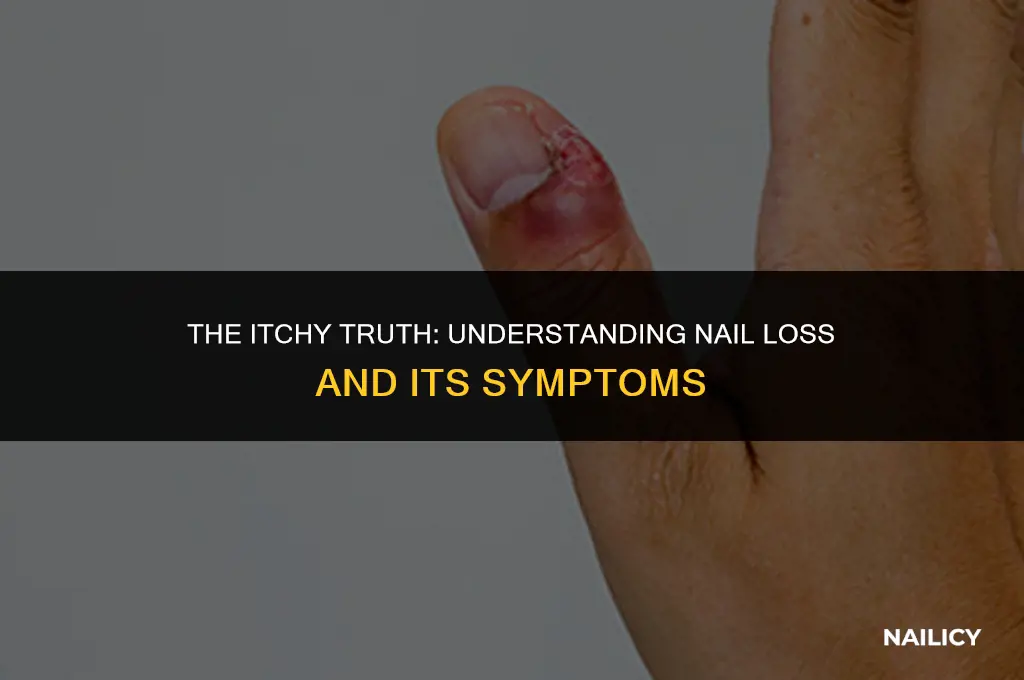 does your nail get itchy before it falls off