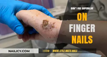 The Surprising Dangers of Superglue on Fingernails: A Cautionary Tale