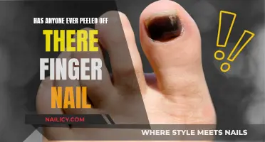 The Surprising Story of a Man Who Peeled Off His Finger Nail