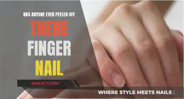 The Strange Sensation of Peeled Fingernails: An Odd Curiosity