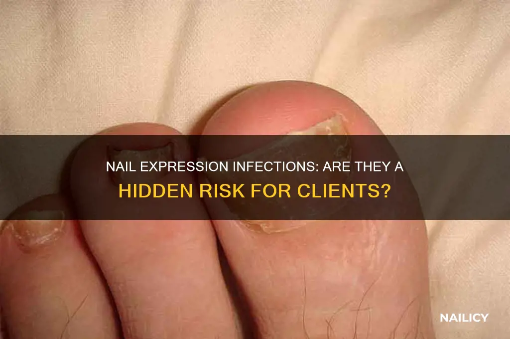 has anyone gotten an infection from nail expression