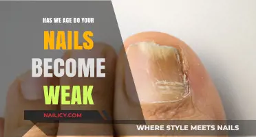 Aging Nails: Why They Weaken and How to Strengthen Them