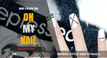 Black Line on My Nail: Causes, Concerns, and When to See a Doctor
