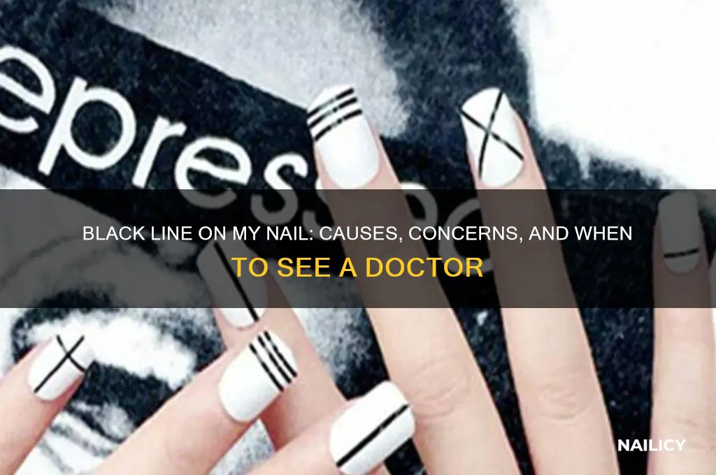 have a black line on my nail
