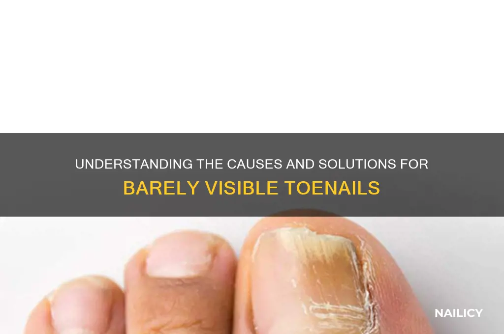 have barely any foot nail
