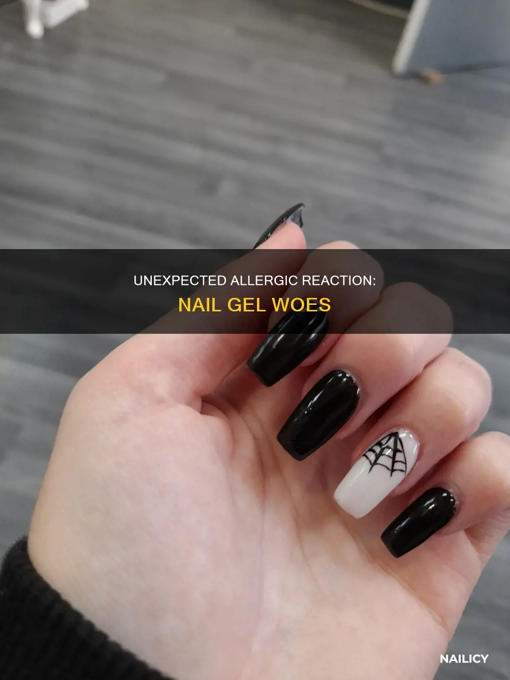 have developed an allergy to nail gel