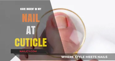 Understanding the Indent at Your Cuticle: Causes and Solutions