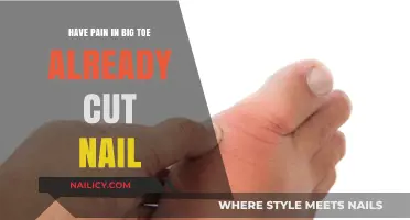 Big Toe Pain: When Trimming Nails Isn't Enough