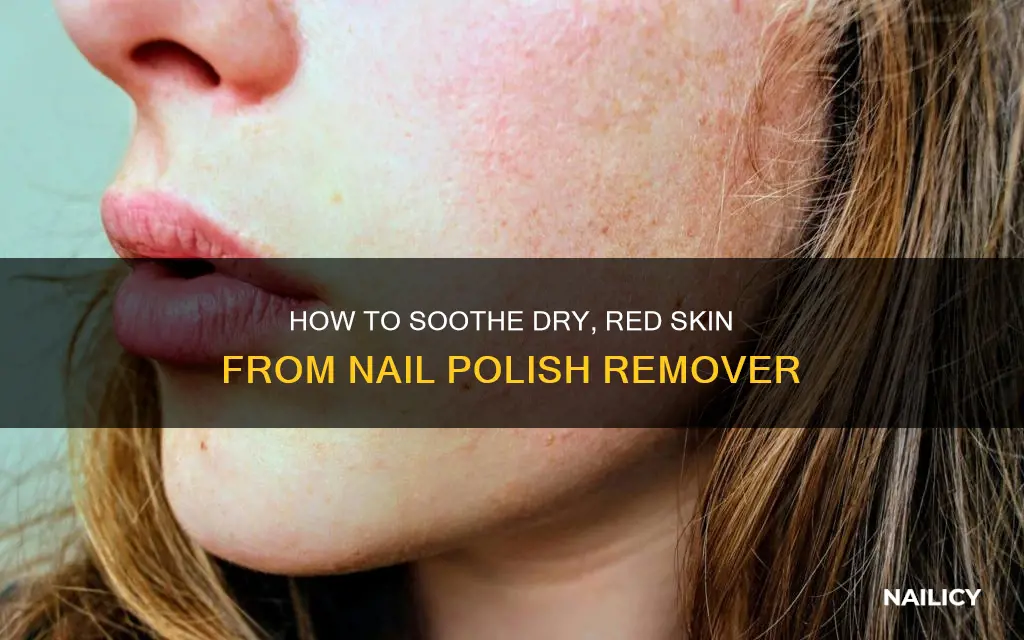 have very dry red face from finger nail polish remover