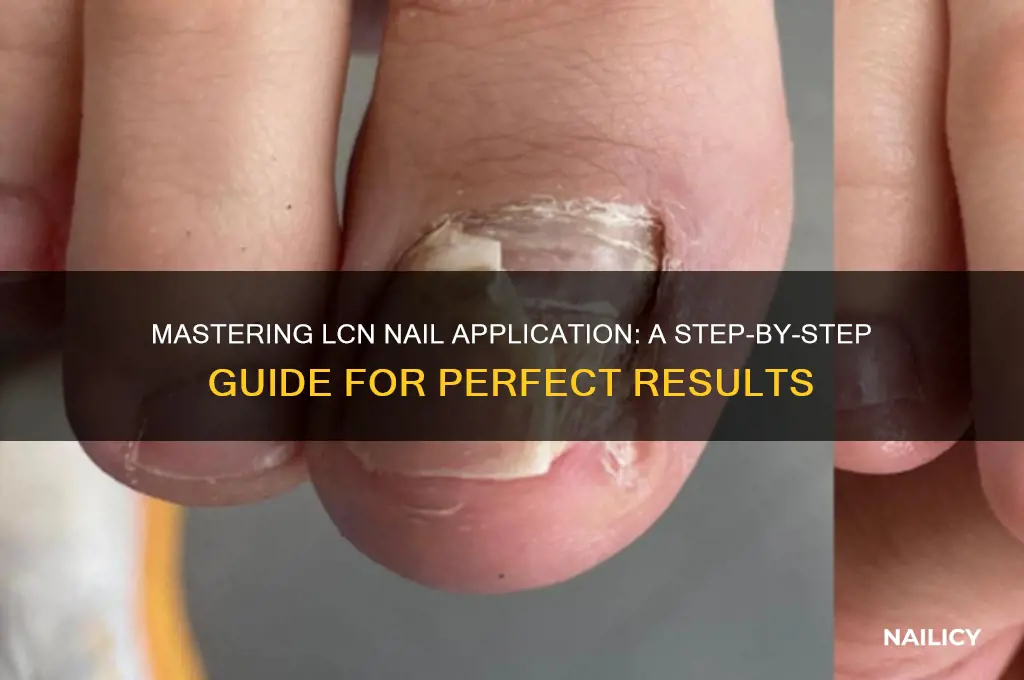 how are lcn nails applied