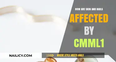 CMML1 Impact: Understanding Skin and Nail Changes in Patients