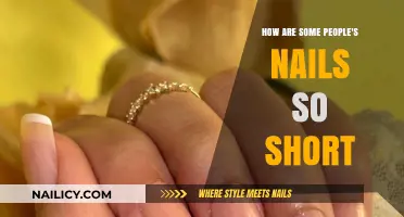 Why Some People Naturally Have Short Nails: Uncovering the Secrets