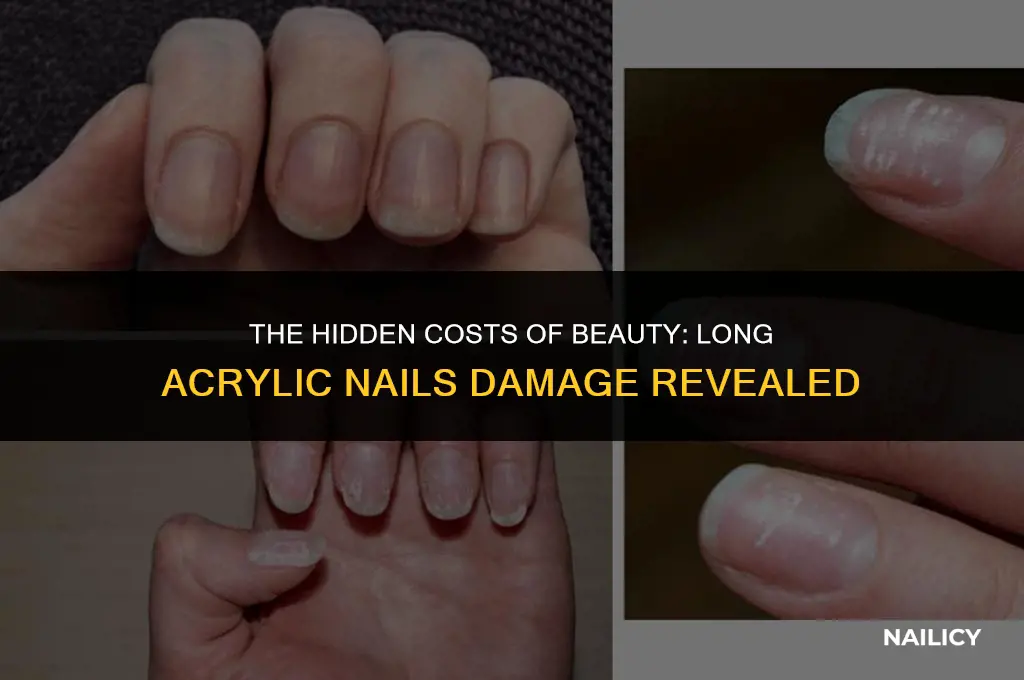 how bad is the damage from getting long acrylic nails