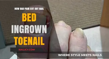 Toe Trauma: Painful Nail Bed and Ingrown Toenail Horrors