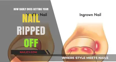 The Surprising Impact of a Ripped Nail: Pain, Healing, and Prevention