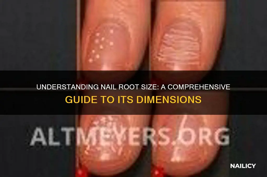 how big is nail root