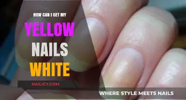 Transform Your Yellow Nails to Brilliant White: A Comprehensive Guide