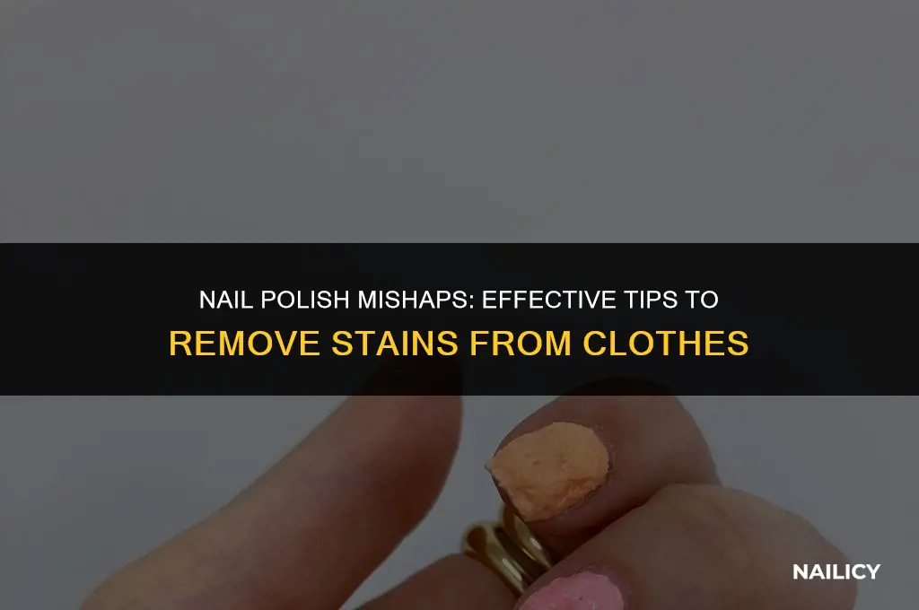 how can i get nail varnish out of clothes