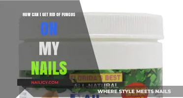 Banish Nail Fungus: Effective Remedies for Healthy Nails