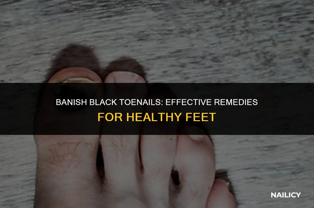 how can i get rid of my black toe nails
