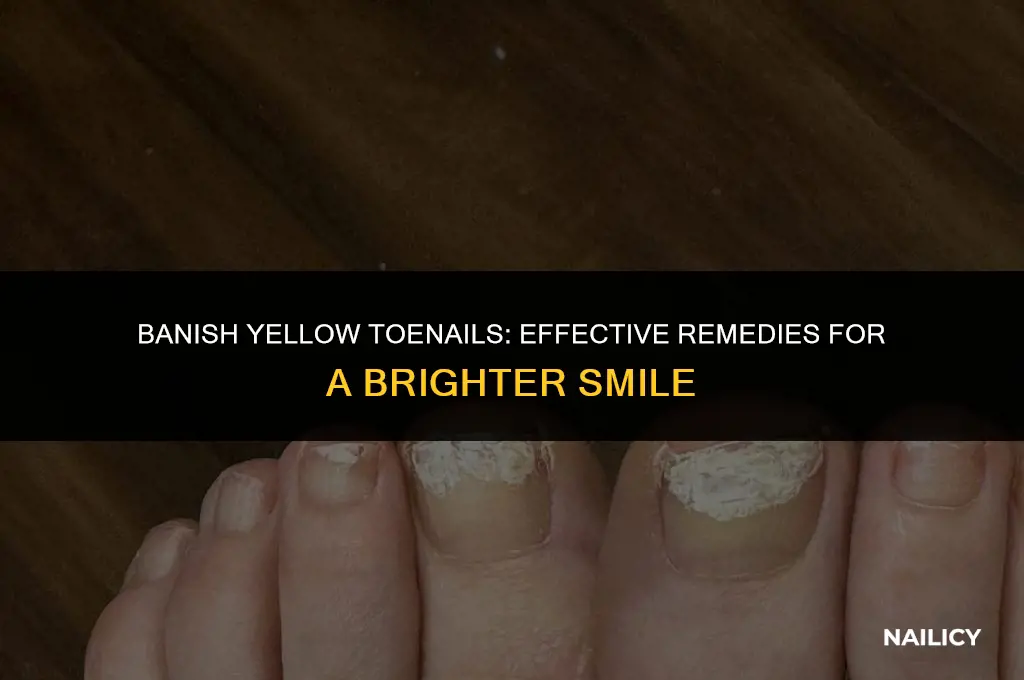 how can i get rid of my yellow toe nails