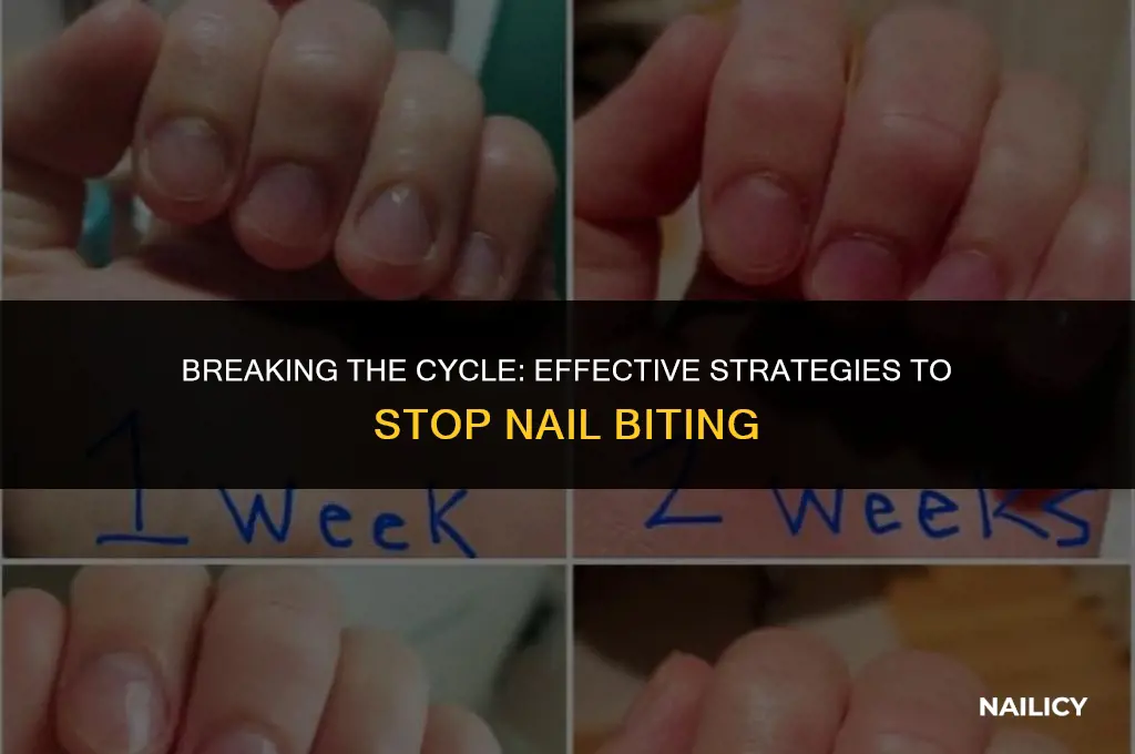 how can i get rid of nail biting habit