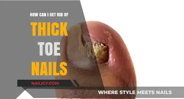 Banish Thick Toenails: Effective Remedies for Healthier Feet