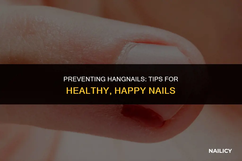 how can i keep from getting a hang nail