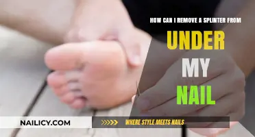 Effective Splinter Removal Techniques for Under Nails