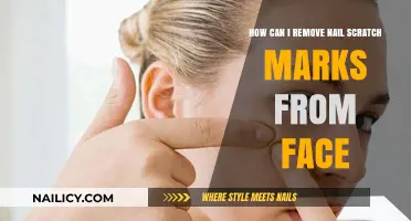Erase Scratch Marks from Your Face Caused by Nails