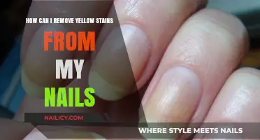 Get Rid of Yellow Nail Stains: Effective Home Remedies