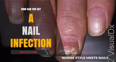 Understanding Nail Infections: Causes, Symptoms, and Prevention Tips