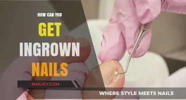 Understanding Ingrown Nails: Causes, Prevention, and Treatment Tips